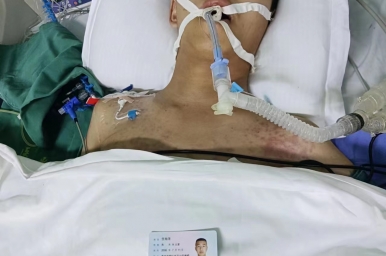 求求大家帮帮我在ICU抢救的弟弟任旭浩
